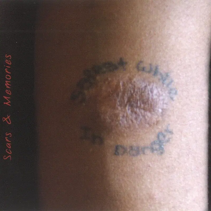 Scars & Memories