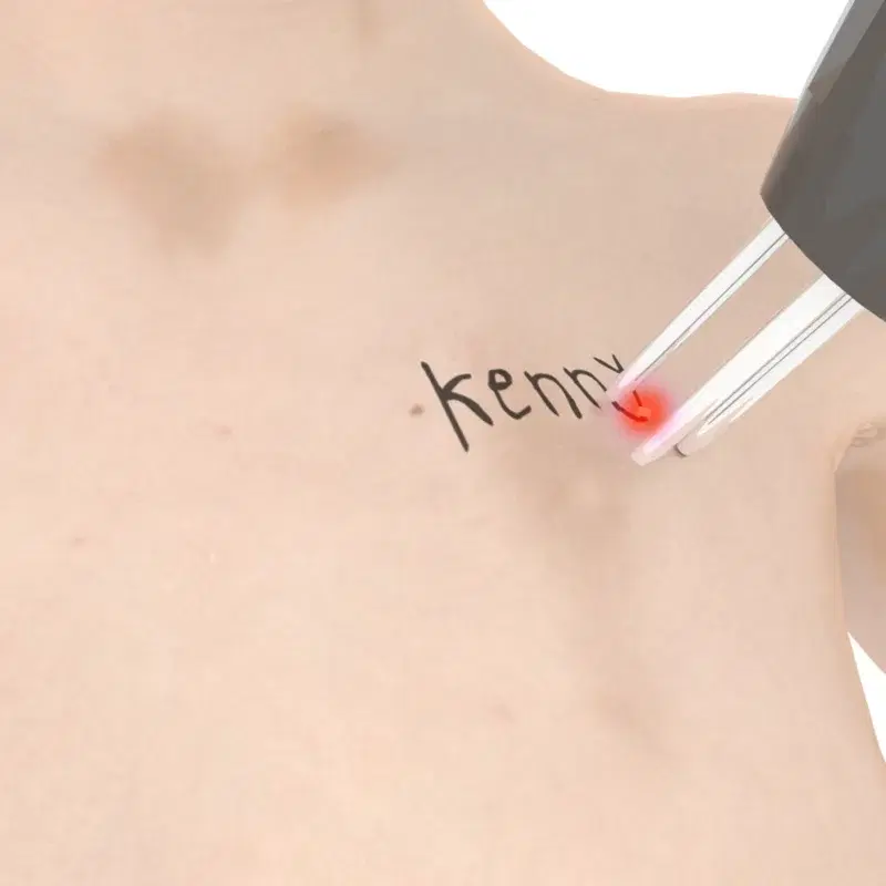 Kenny