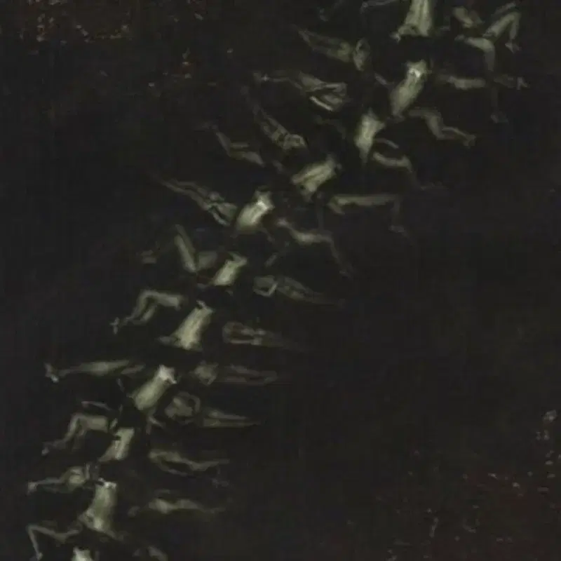 human centipede