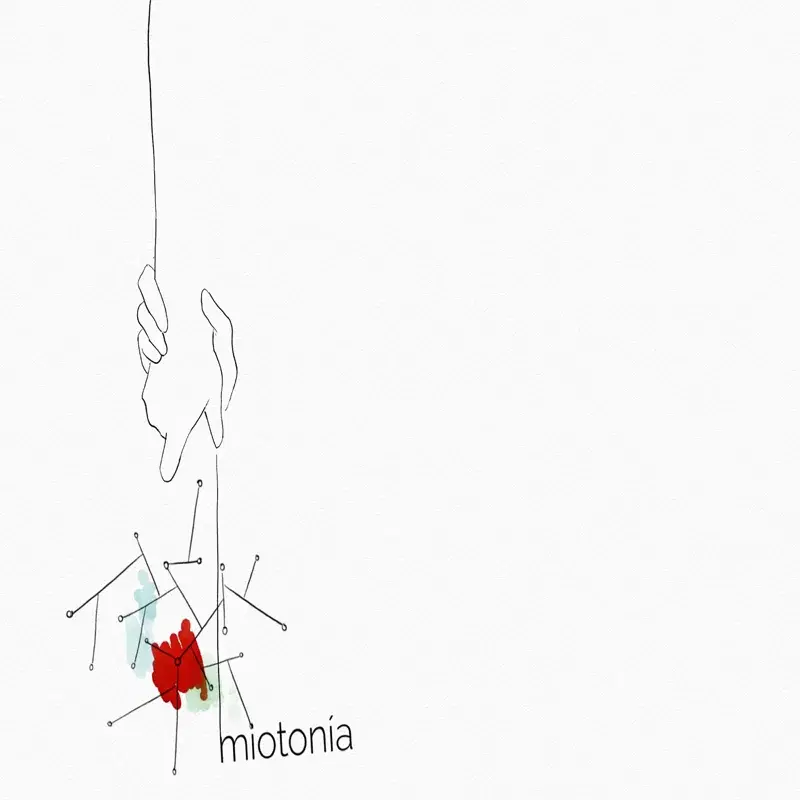 Miotonía