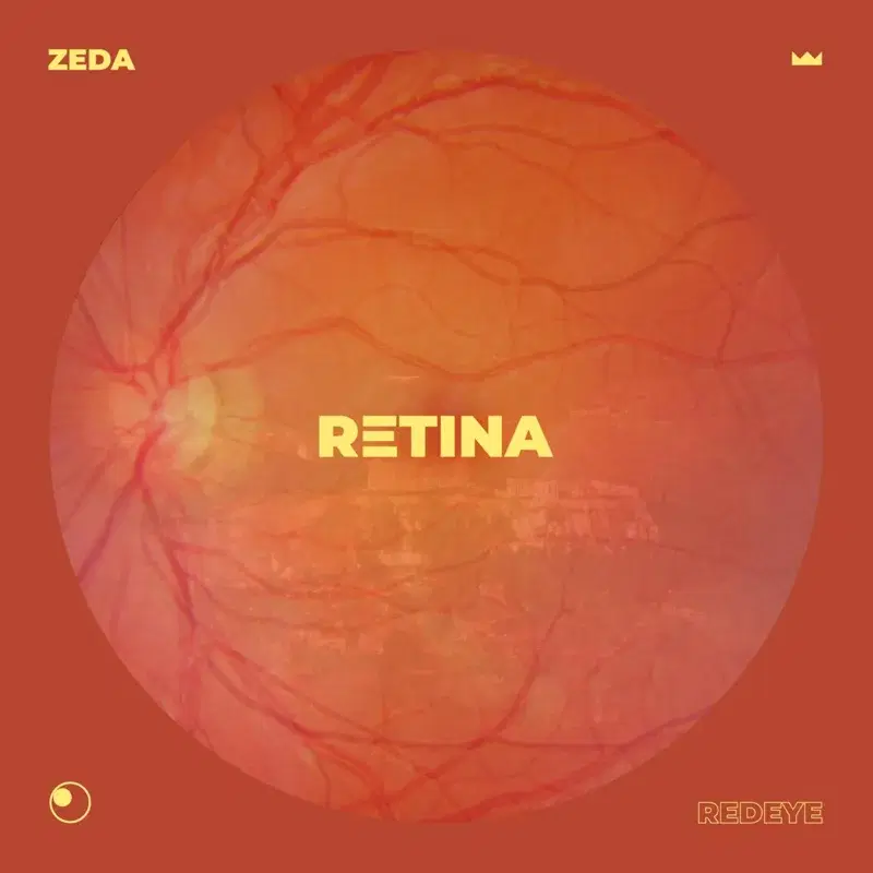 Retina