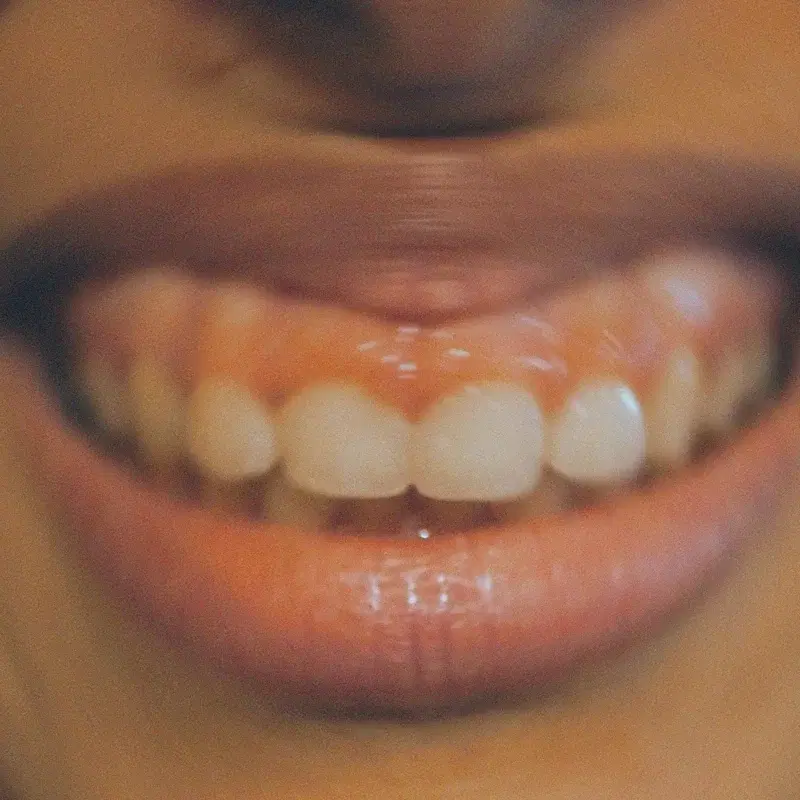 Don't speak
